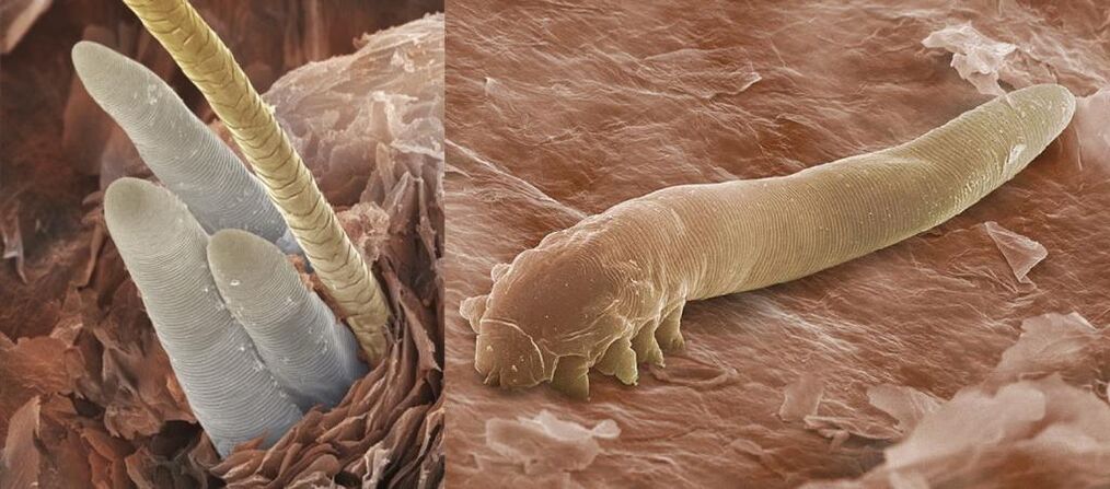 Ektoparasiten