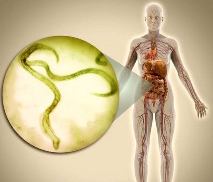 Parasiten im Körper