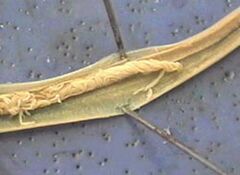 Parasit